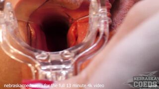Becky Berry Gyno Exam with Speculum & 6 Gaping Orgasms