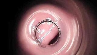 Lesbian Gyno Exam With Enema